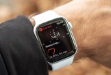 Apple Watch có thể cảnh báo người dùng về triệu chứng của nhồi máu cơ tim