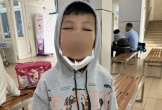 Bé trai 8 tuổi không mở được mắt sau chữa đau răng tại phòng khám tư