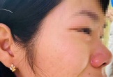 Làm rõ vụ việc phụ huynh xông đến nhà hành hung cô giáo