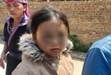 Đình chỉ công tác cô giáo ở Yên Bái bị tố đánh học sinh bầm mắt
