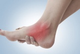 Những triệu chứng ở bàn chân có thể là dấu hiệu của bệnh tim