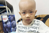 Mong giúp đỡ bé trai 4 tuổi bị ung thư não
