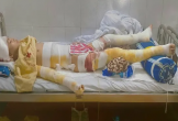 Cháu trai bị bỏng nặng không có tiền chữa trị