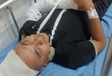 Nghi án tranh giành địa bàn cứu hộ, một tài xế bị đánh gãy tay